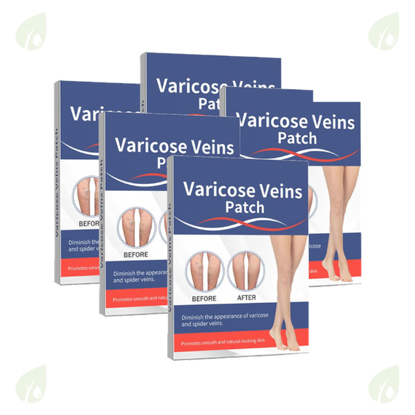Varicose